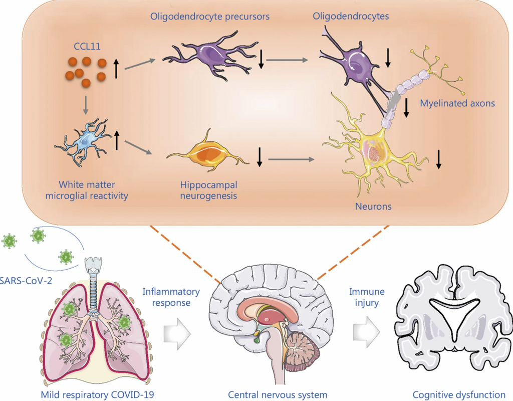 featured image thumbnail for post Brain Fog After COVID-19